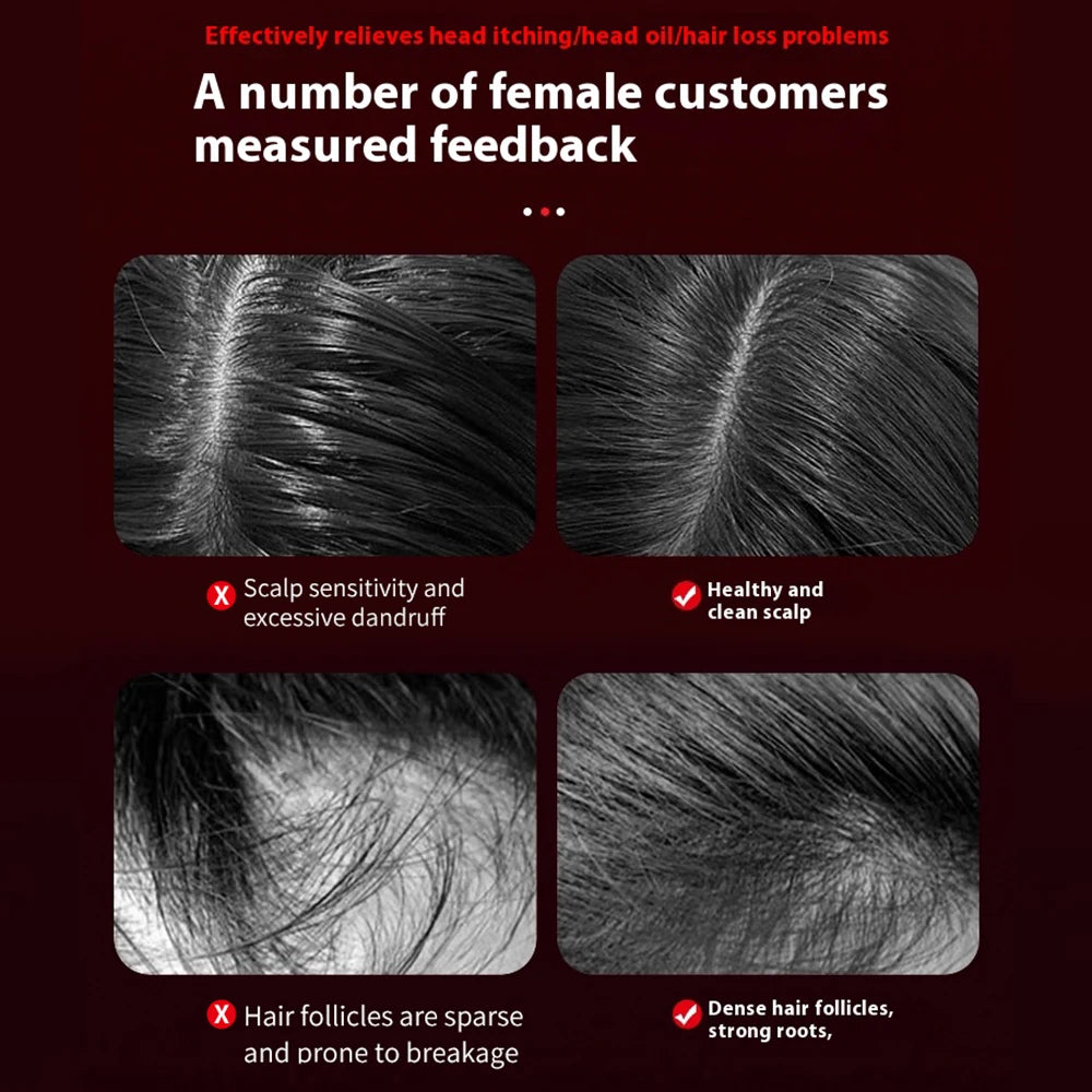 Hair Massage Comb